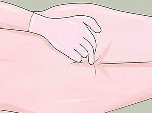 Những bệnh về hậu môn thường gặp