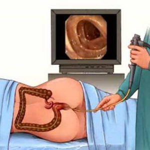 Các phương pháp kiểm tra bệnh trĩ