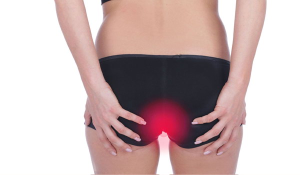 Bệnh lòi dom là gì ?