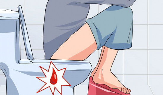 Triệu chứng bệnh lòi dom