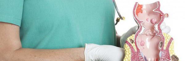 Làm sao để bệnh trĩ không tái phát trở lại?