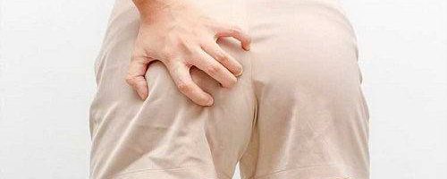 Ngứa hậu môn là bệnh gì, cách điều trị?