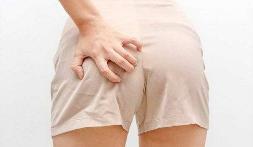 Ngứa hậu môn là bệnh gì, cách điều trị?