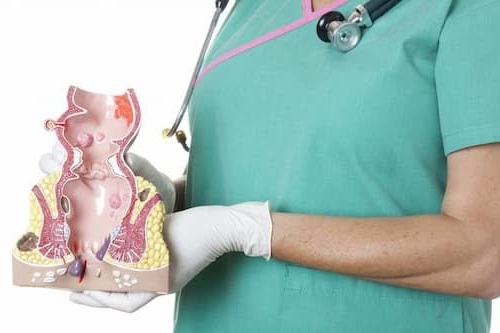 Bệnh trĩ ngoại có nguy hiểm không
