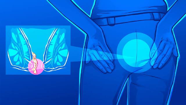 Bệnh trĩ ra máu và những biến chứng