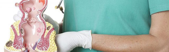 Trĩ huyết khối là gì, phân loại?