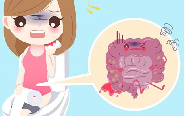 6 nguyên nhân gây tình trạng đau hậu môn và cách khắc phục